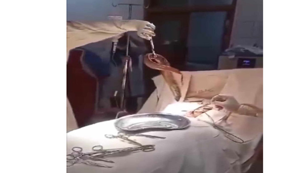 পায়ুপথে ঢুকলো কুঁচিয়া মাছ