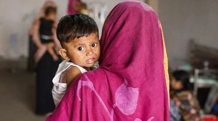 হাম ও হামের উপসর্গ নিয়ে ২৪ ঘণ্টায় আরও ১০ শিশুর মৃত্যু