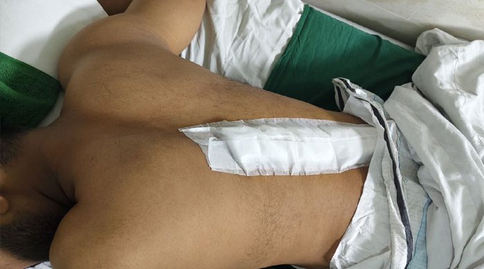 মোহাম্মদপুরে পুলিশ কর্মকর্তাকে ছুরিকাঘাত, লাগল ৪৩ সেলাই