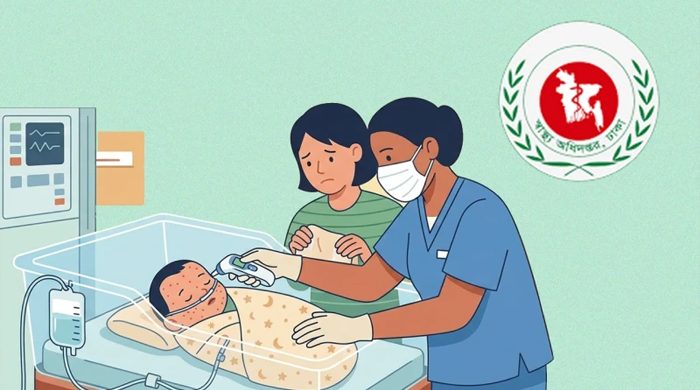 হাম উপসর্গে আরও ৬ শিশুর মৃত্যু