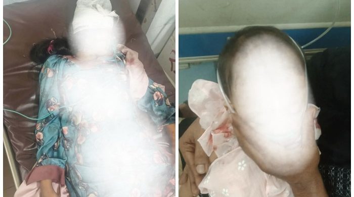 সিলেটে বাসের ধাক্কায় মা-মেয়ের মৃত্যু, আহত ৩